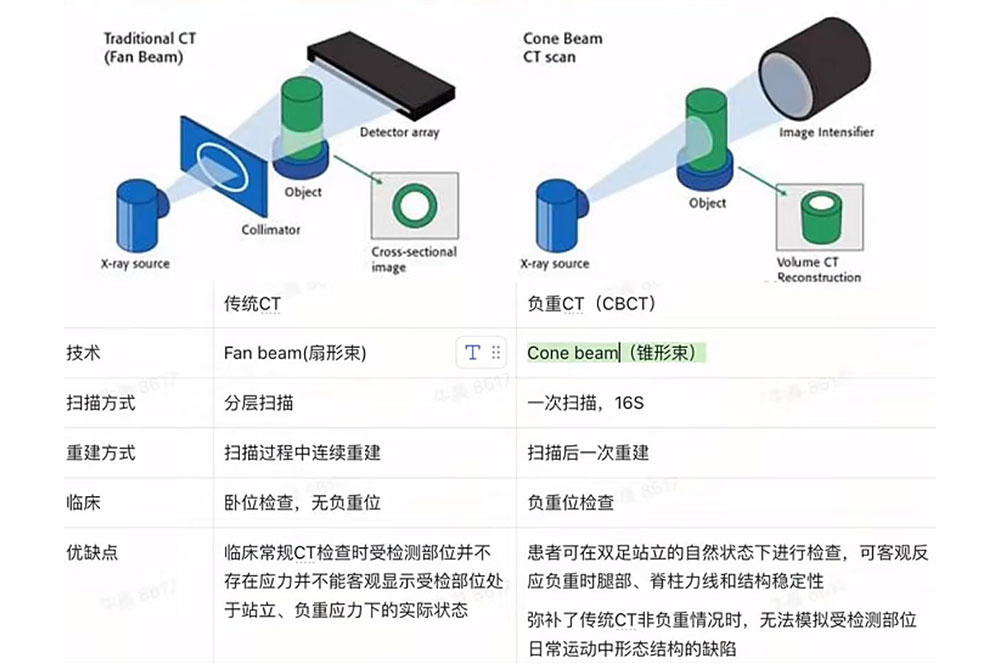 負重CT和傳統CT有(yǒu)何不同?